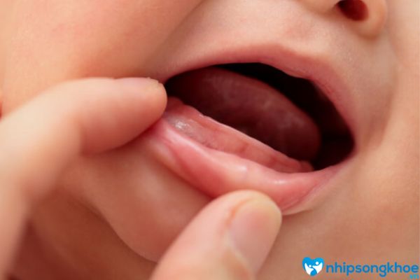 10 mẹo cho bé chậm mọc răng đơn giản và nhanh chóng