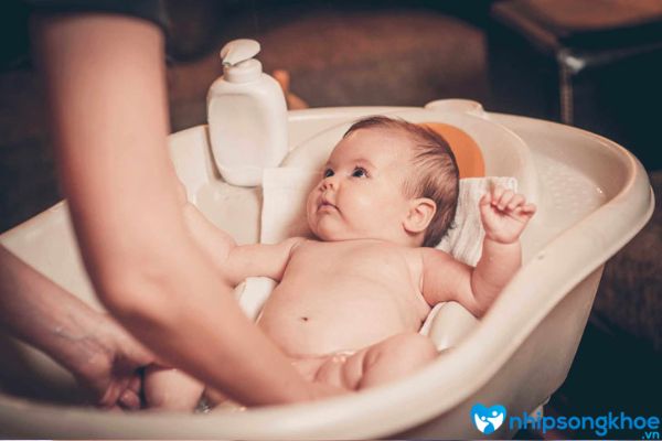 Cách phòng tránh vết chàm sữa ở trẻ sơ sinh