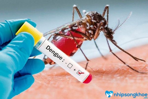 Phác đồ điều trị sốt xuất huyết Dengue chính xác