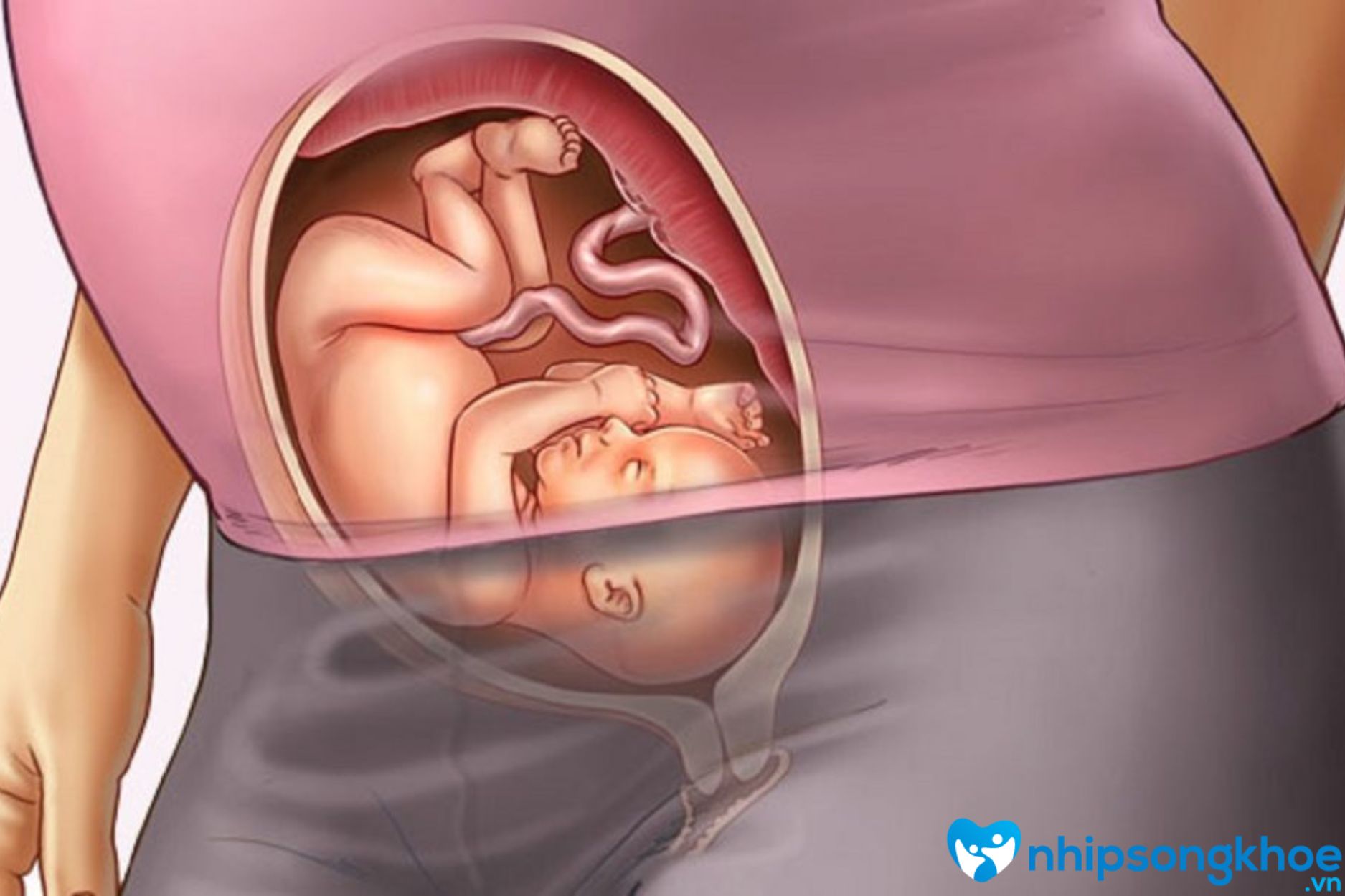 Bẩm sinh khi trong tử cung mẹ là dầu hiệu trẻ sơ sinh bị gù lưng