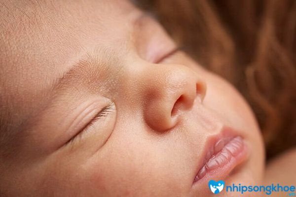 hiện tượng trẻ sơ sinh bị rộp trắng ở môi là hết sức bình thường