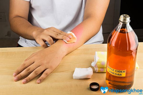Sử dụng giấm trong điều trị da tay bị cháy nắng